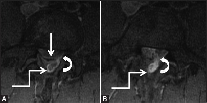 Figure 4b (A and B)