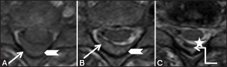 Figure 24b (A-C)