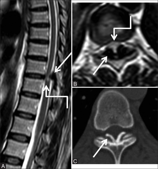 Figure 6 (A-C)