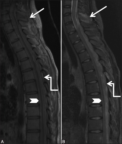 Figure 10a (A and B)