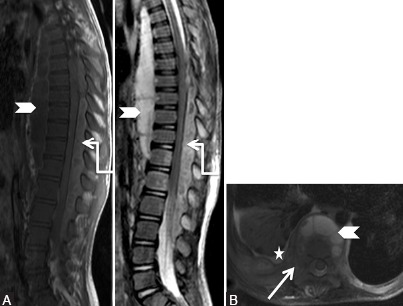 Figure 11 (A and B)