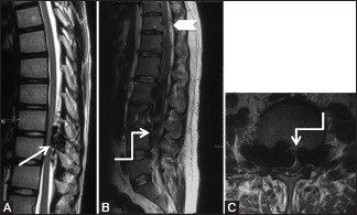 Figure 17 (A-C)