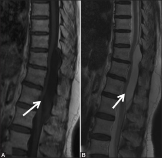 Figure 18a (A and B)