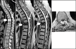 Figure 14 (A-D)