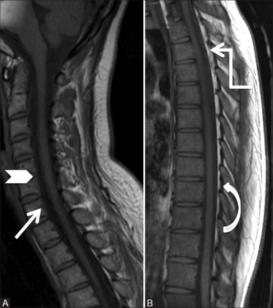 Figure 1 (A and B)