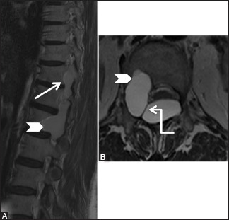 Figure 18b (A and B)