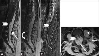 Figure 13 (A-D)