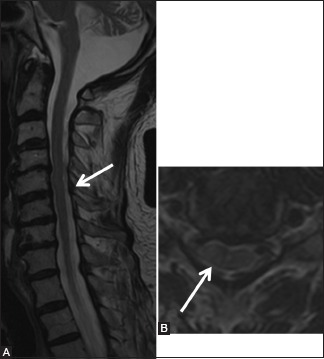 Figure 23b (A and B)