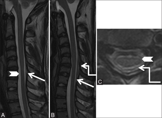 Figure 26 (A-C)