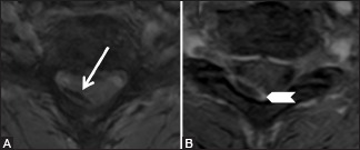 Figure 22b (A and B)