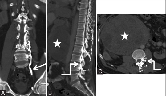 Figure 25 (A-C)