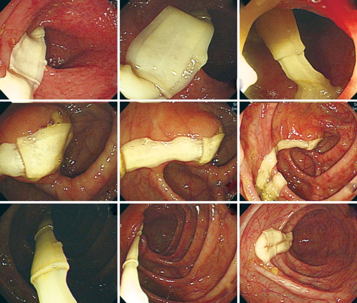 Fig. 2