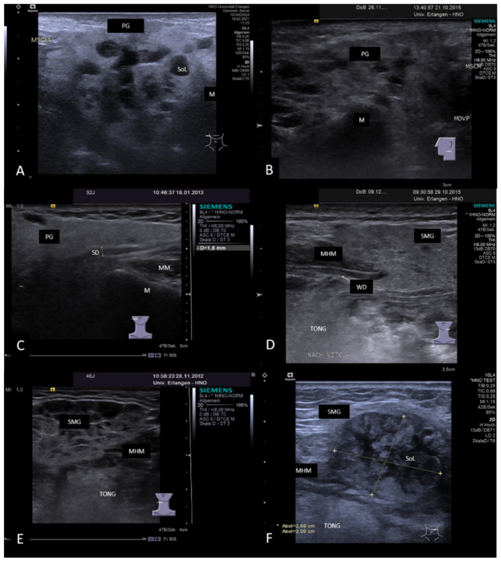 Figure 16