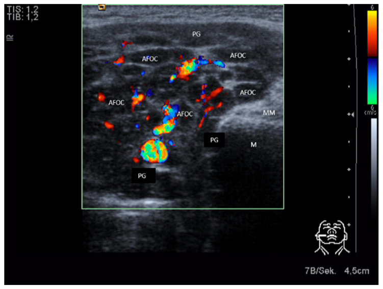 Figure 14