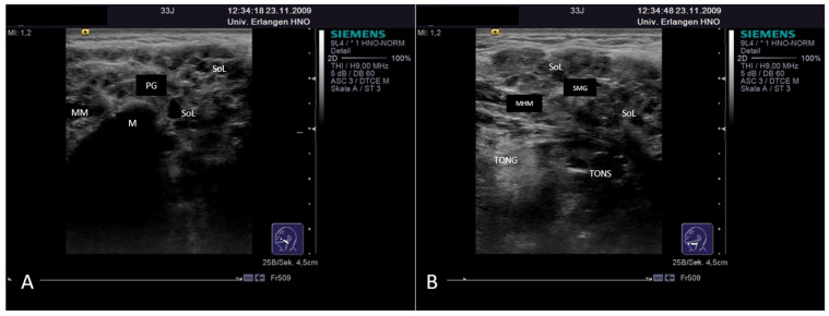 Figure 13