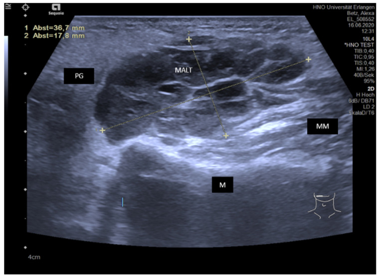 Figure 15