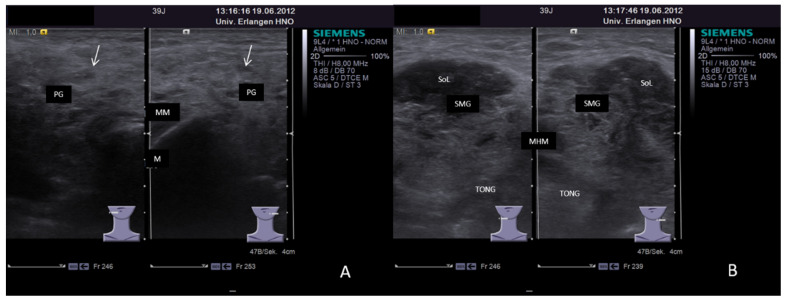 Figure 18