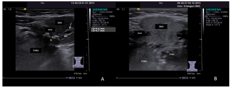 Figure 19