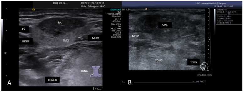 Figure 17