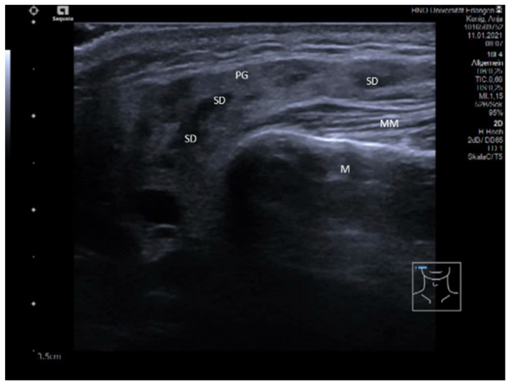 Figure 10