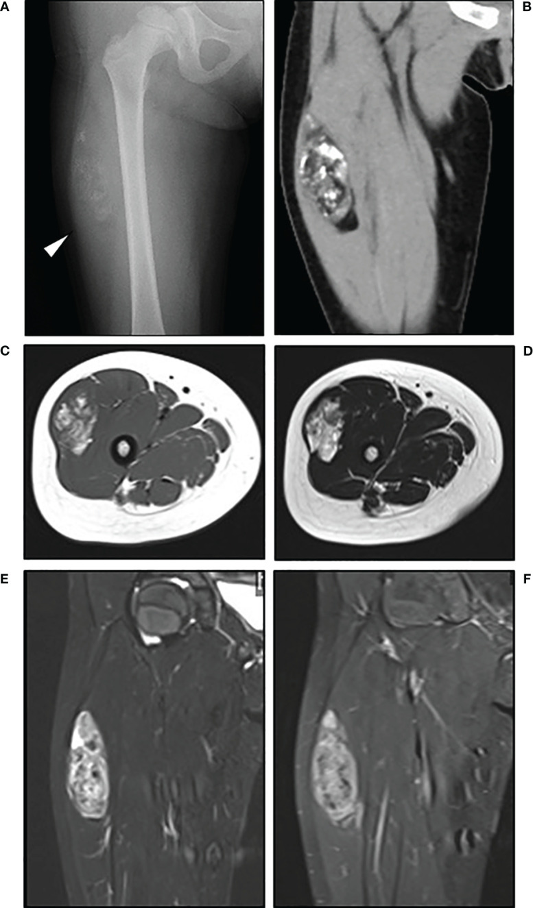 Figure 1