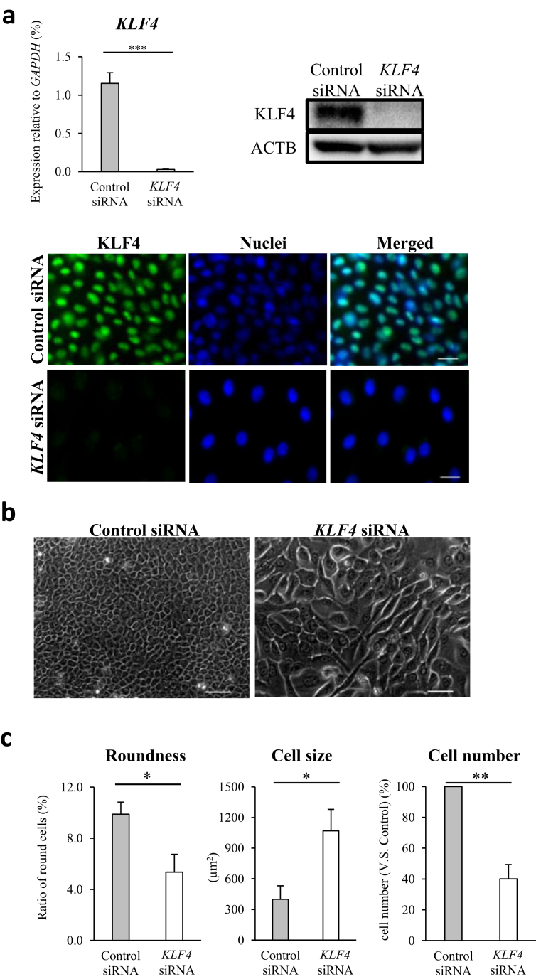 KLF4 prevents epithelial to mesenchymal transition in human corneal ...