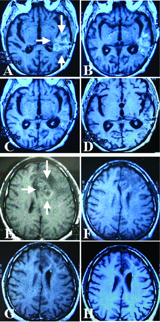 Fig 6.