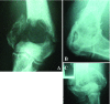 Fig 3.