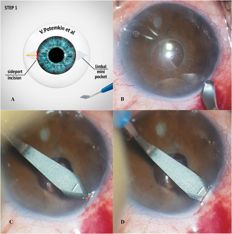 Fig. 1