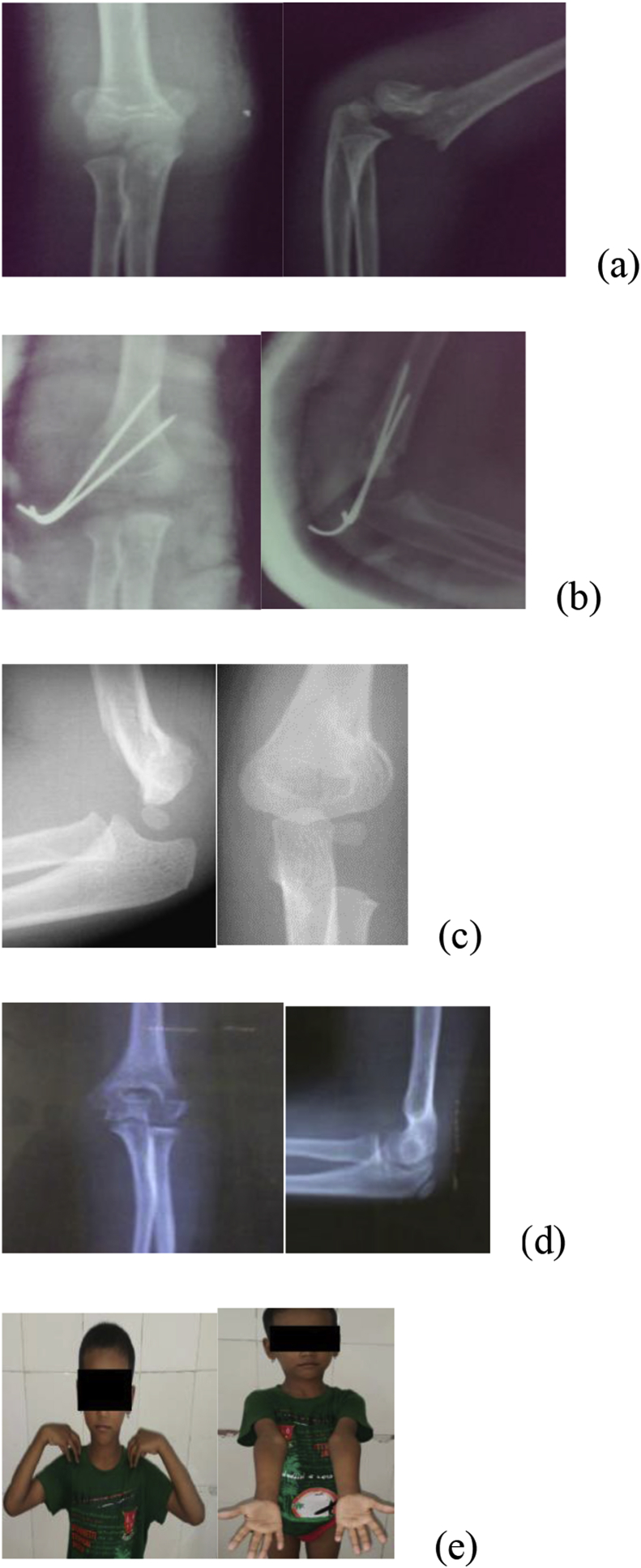 Fig. 1