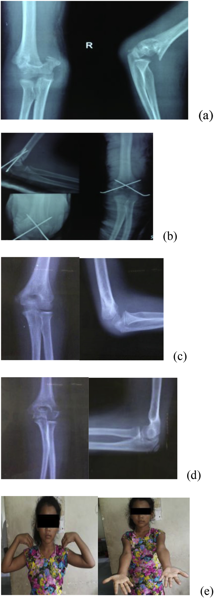 Fig. 2