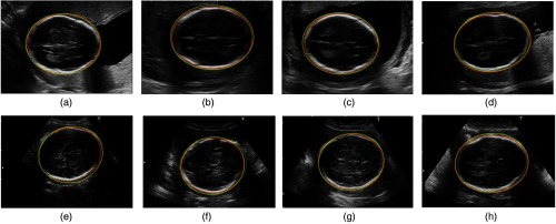 Fig. 6