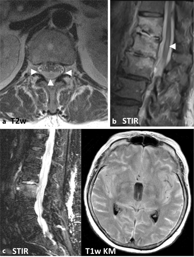 graphic file with name 117_2021_814_Fig1_HTML.jpg