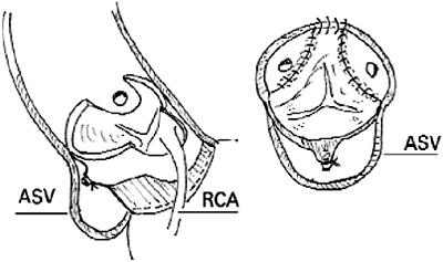 graphic file with name 7FF2.jpg