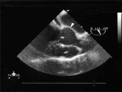 graphic file with name 7FF1.jpg