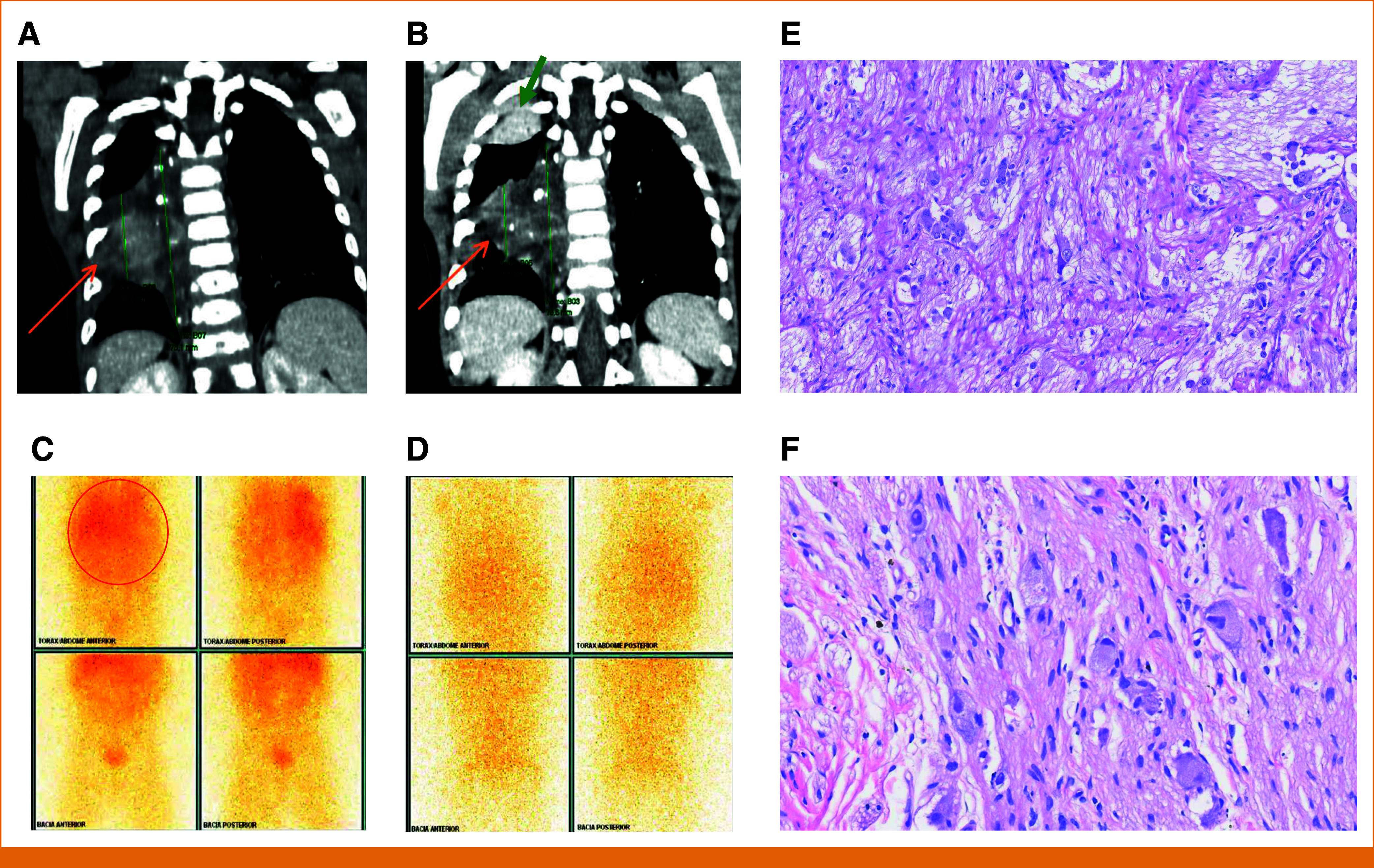 FIG 3.