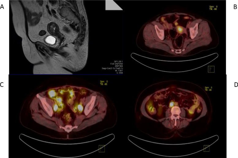 Fig. 1