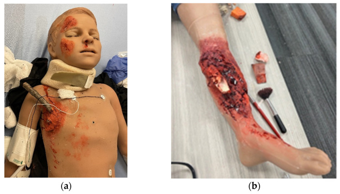 Figure 2