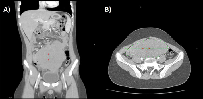 Fig. 1 –