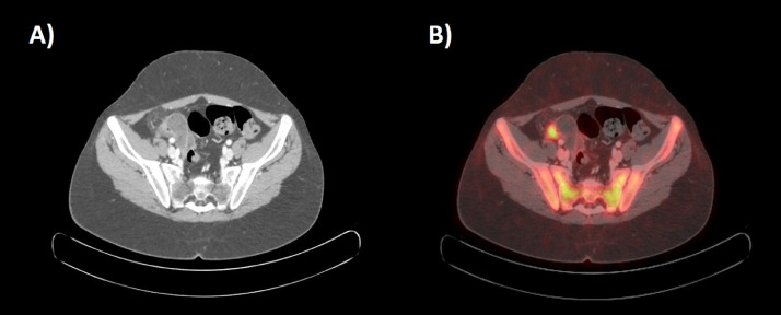 Fig. 3 –