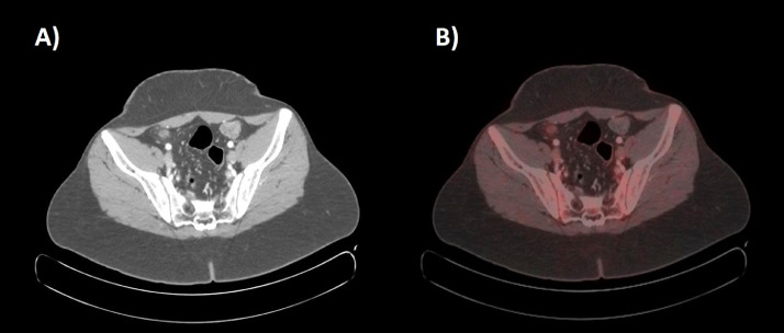 Fig. 7 –