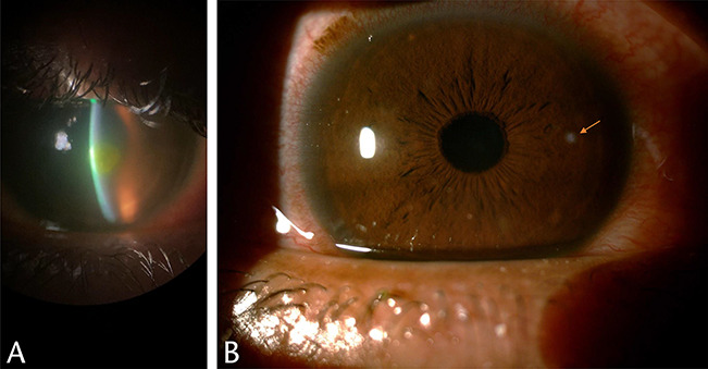 FIG. 1.