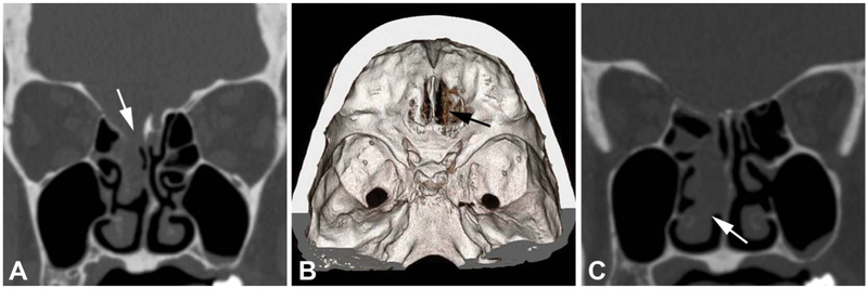 FIG. 1.