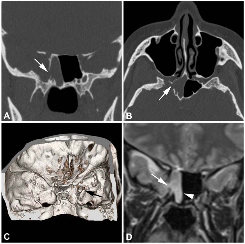 FIG. 2.