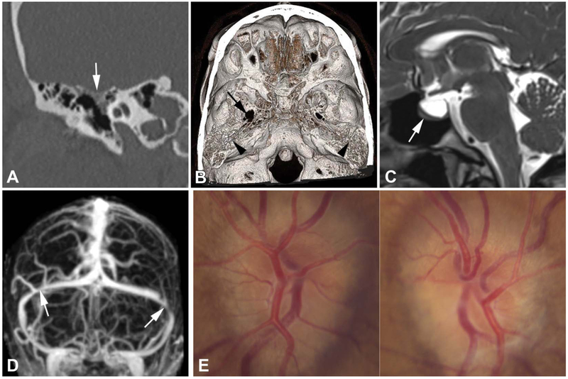 FIG. 3.