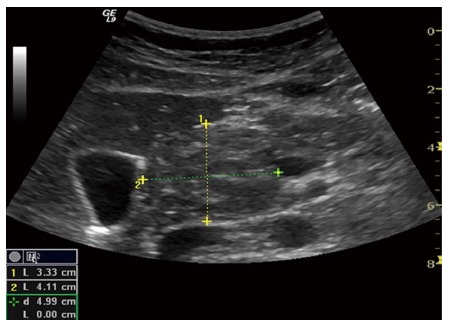 Figure 11