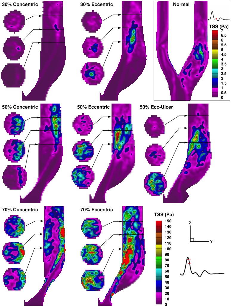 Figure 11