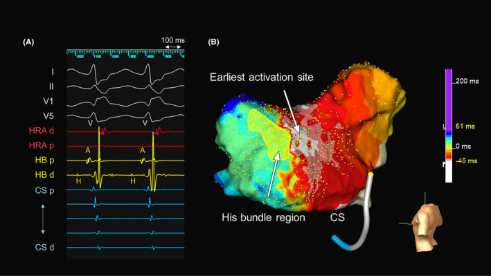 FIGURE 1