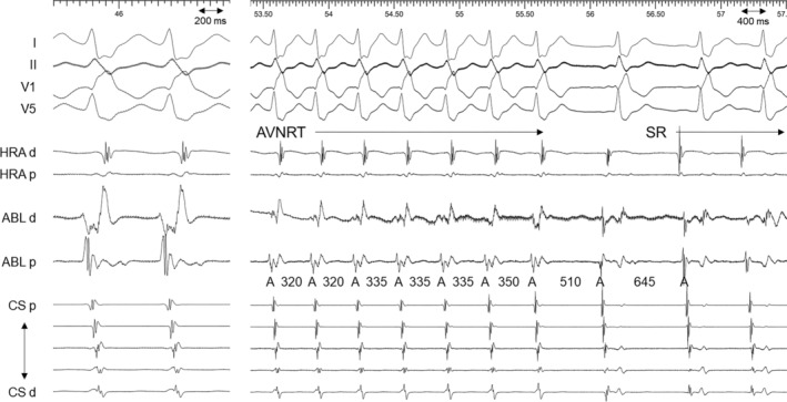 FIGURE 3