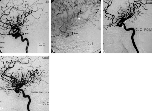 Fig 2.